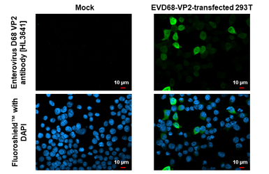 Anti-Enterovirus D68 VP2 antibody [HL3641] used in Immunocytochemistry/ Immunofluorescence (ICC/IF). GTX641632